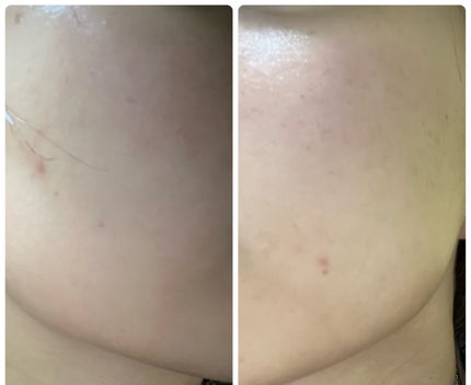 ぽむ on LIPS 「1枚目 2025.12.17エピデュオ 826日目2枚目 20..」(2枚目)