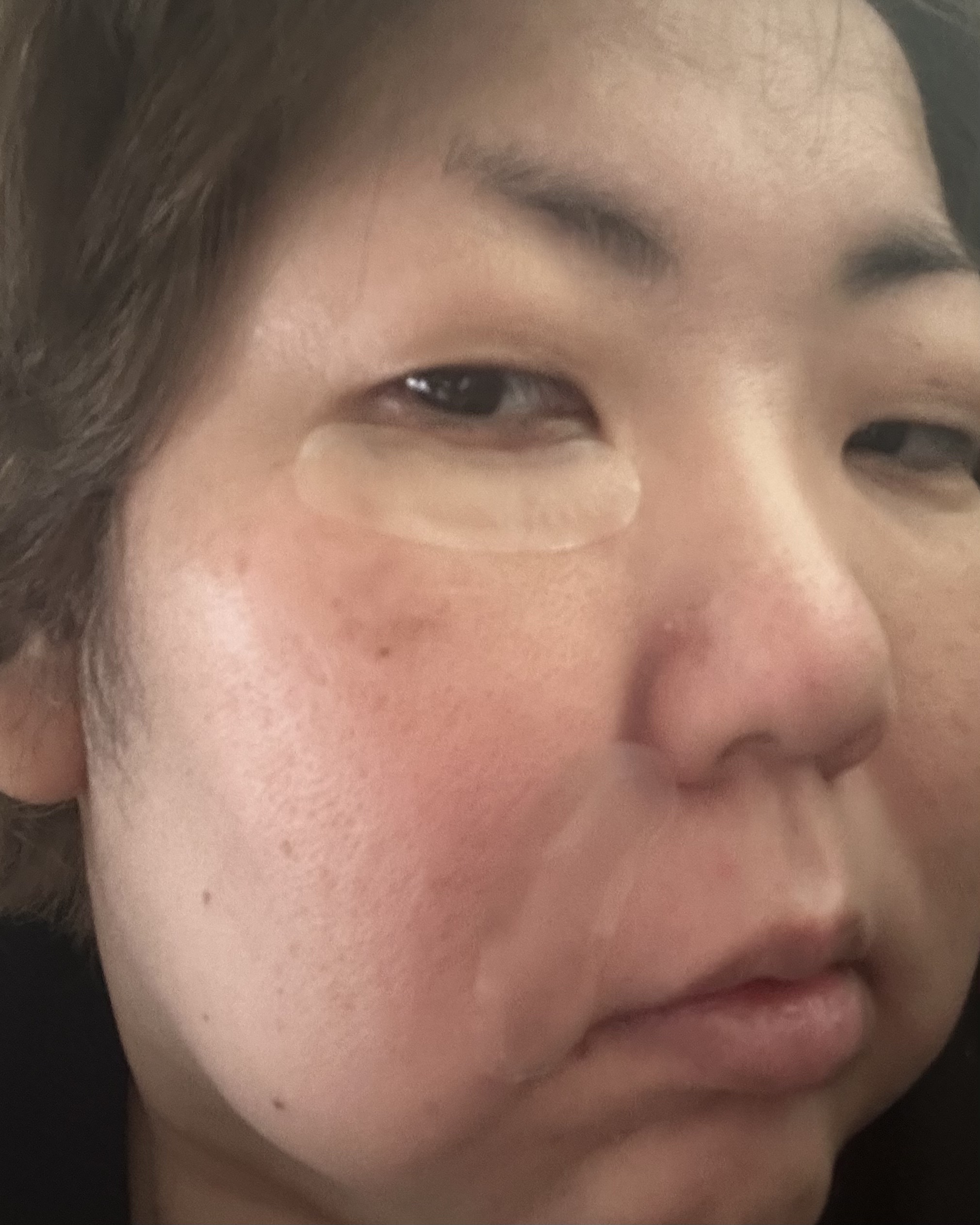 レチアールエヌ スリムパッチ/ACROPASS/シートマスク・パックを使ったクチコミ（3枚目）