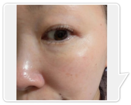 マスクフォンデュ/Quanis/シートマスク・パックを使ったクチコミ(6枚目)