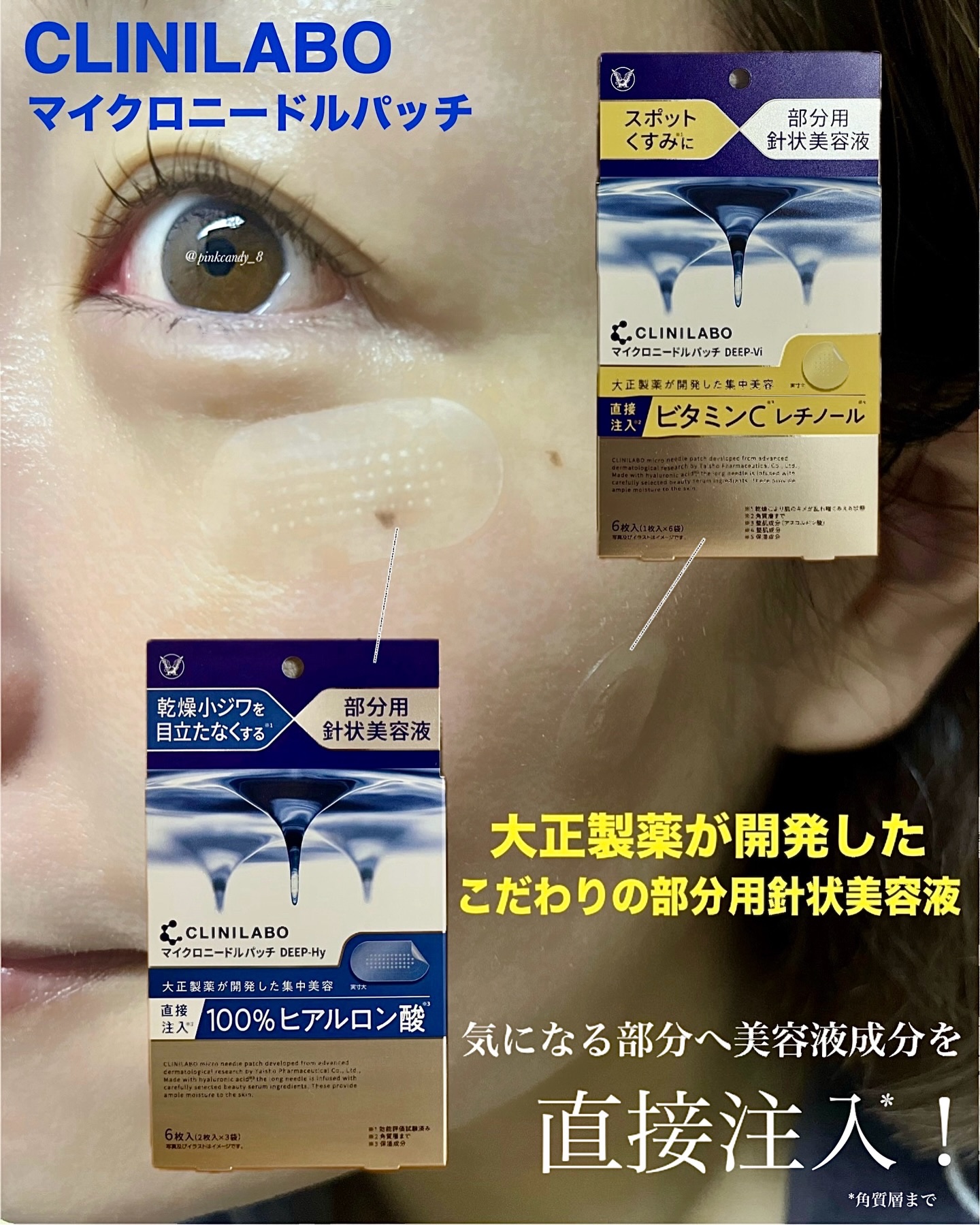 クリニラボ マイクロニードルパッチ ディープ-Hy/大正製薬/シートマスク・パックを使ったクチコミ（1枚目）