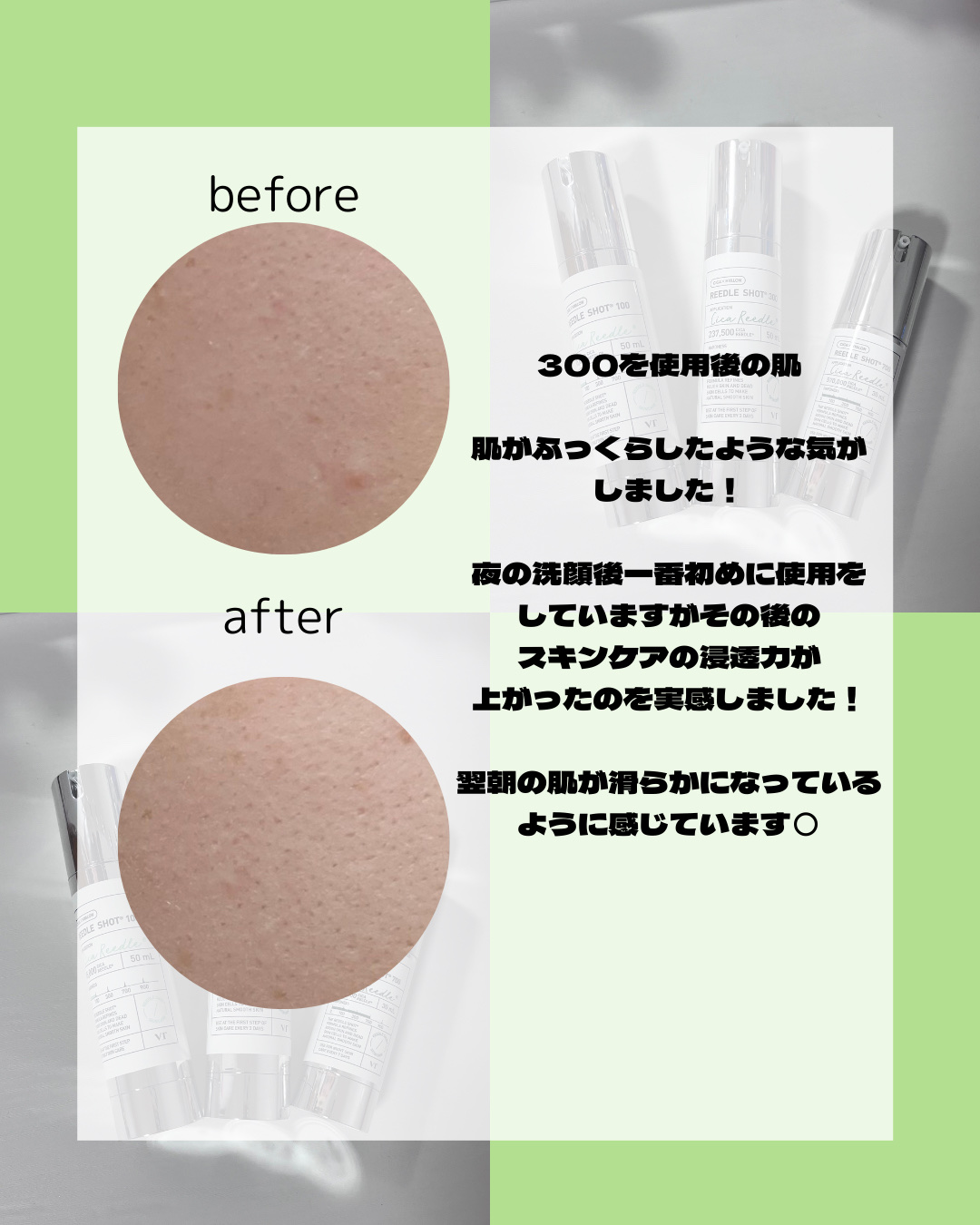 を使ったクチコミ（2枚目）