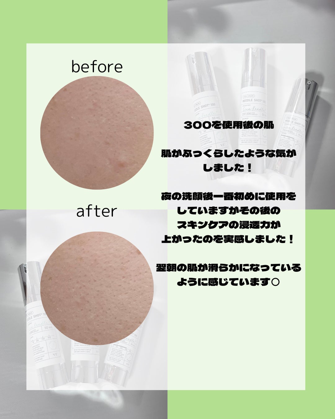 MooN on LIPS 「VTリードラーズとしての投稿です🪡VT(ブイティ―)リードルシ..」(2枚目)