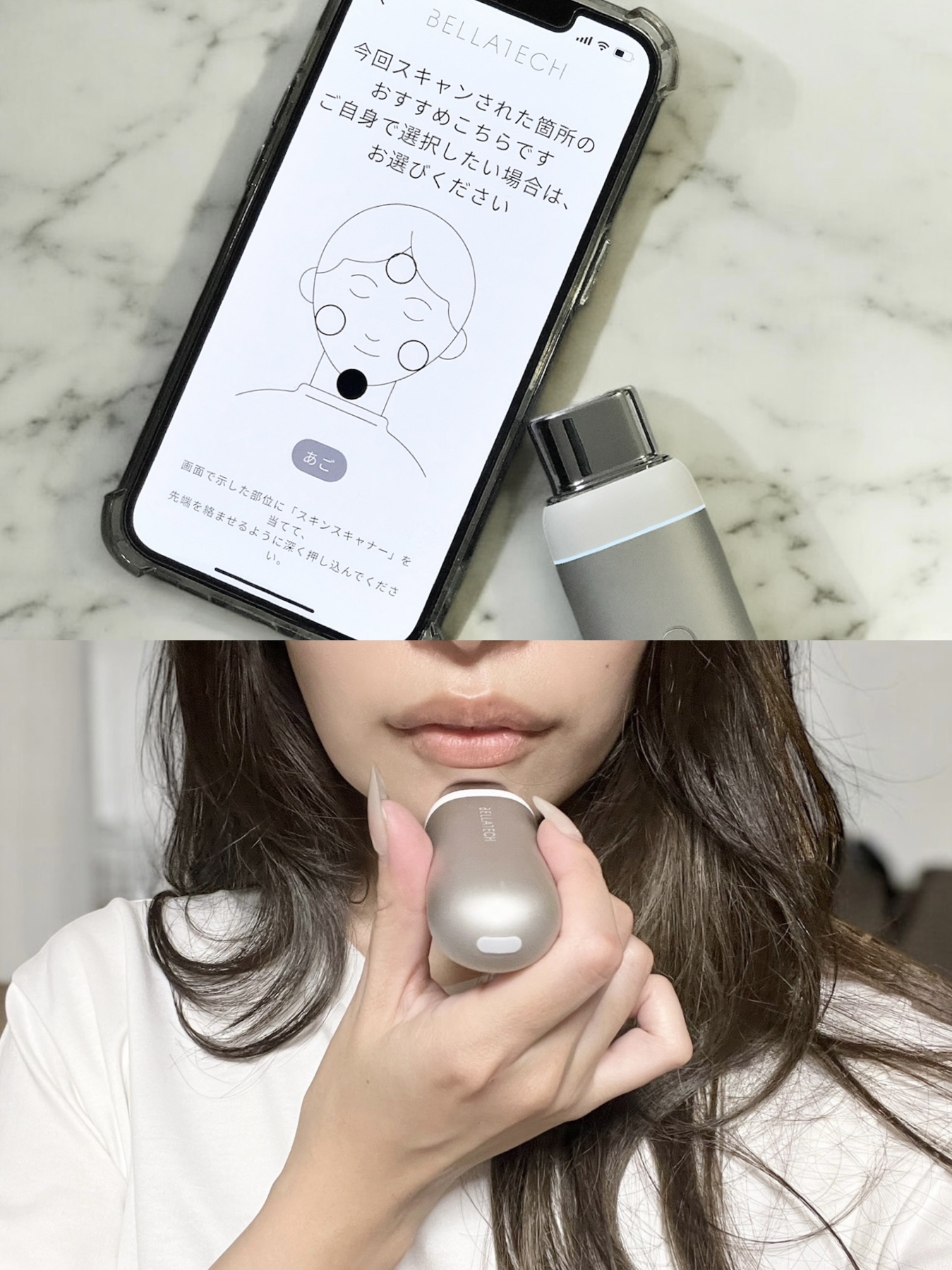 スキンスキャナー/BELLATECH/その他スキンケアグッズを使ったクチコミ（3枚目）
