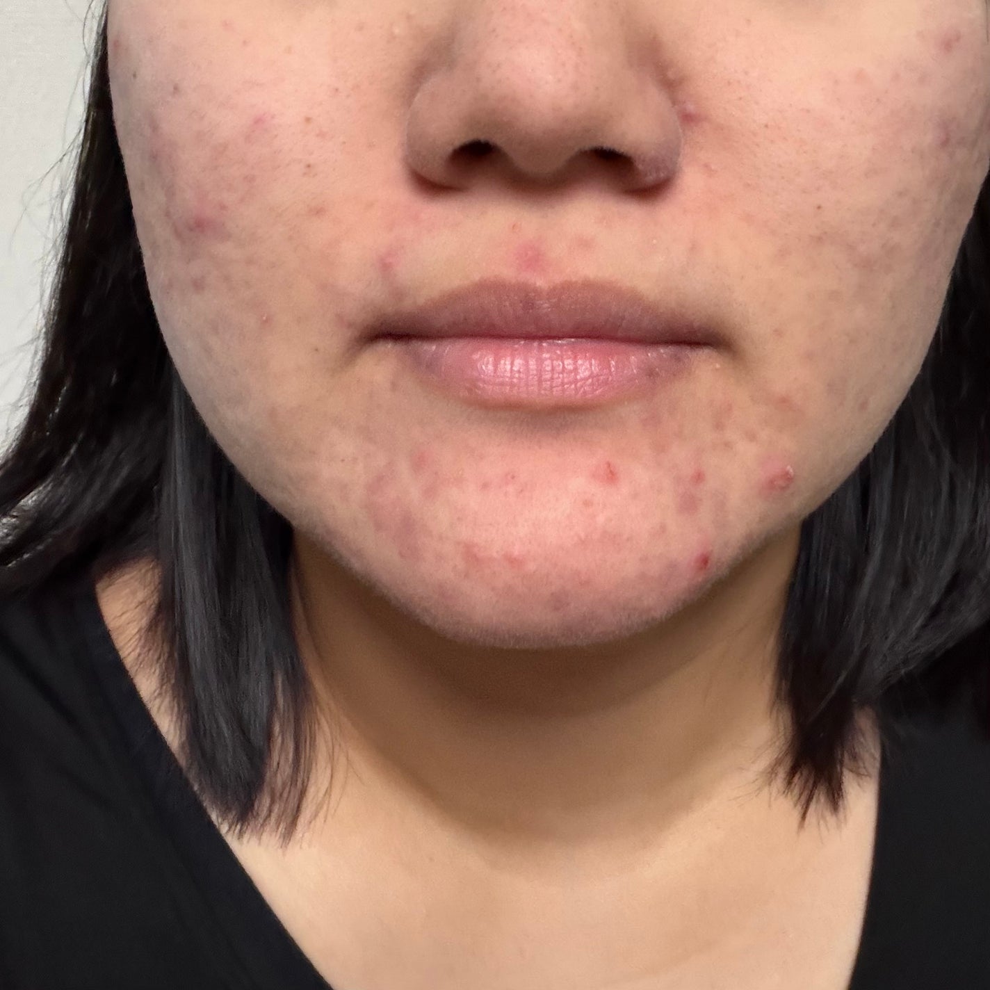 CCPローション/ibodle/化粧水を使ったクチコミ(6枚目)