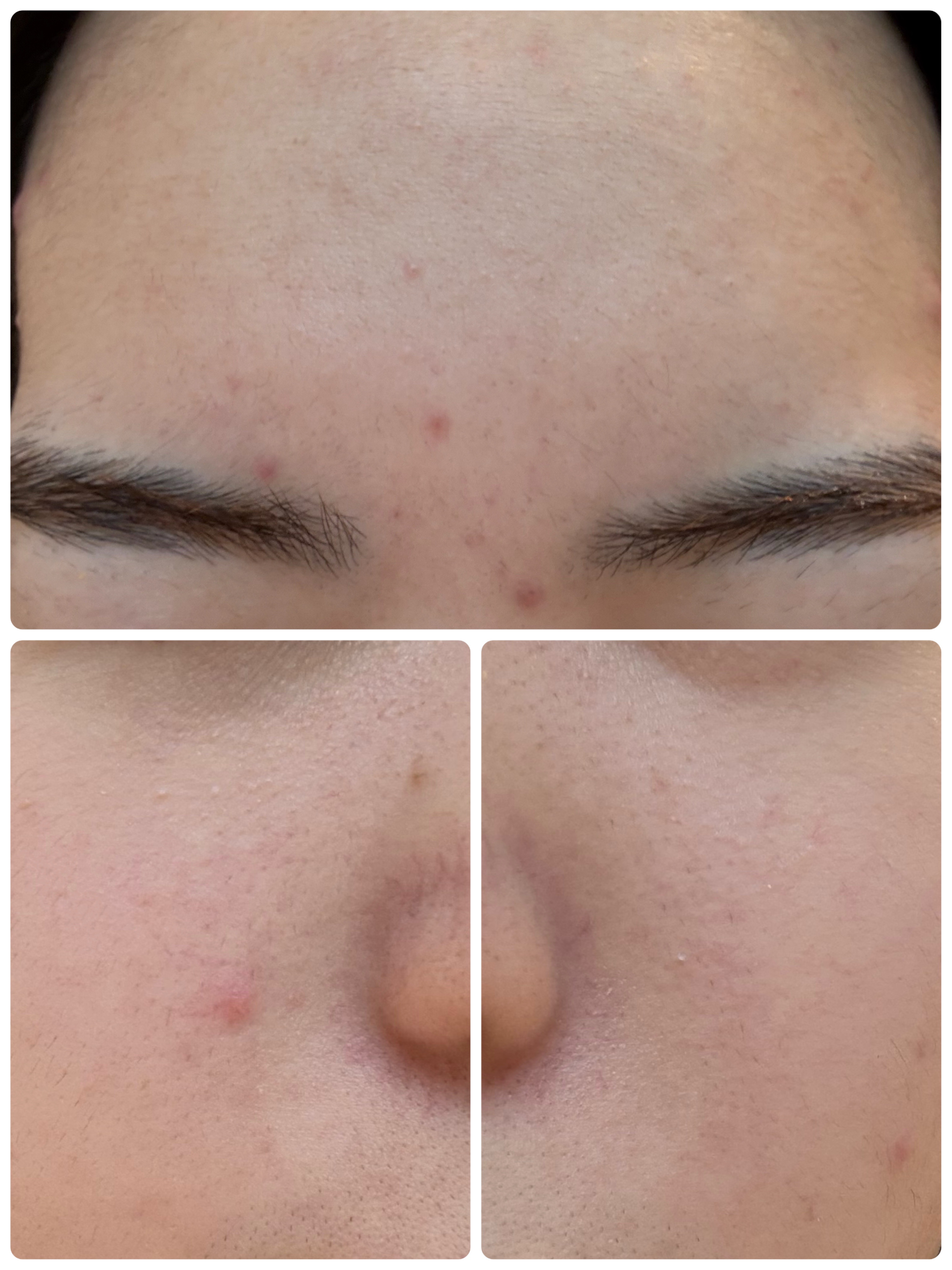 PDRN テンショントナーパッド/VT/トナーパッドを使ったクチコミ（3枚目）