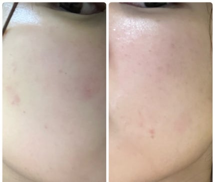 ぽむ on LIPS 「1枚目 2025.12.17エピデュオ 826日目2枚目 20..」(5枚目)