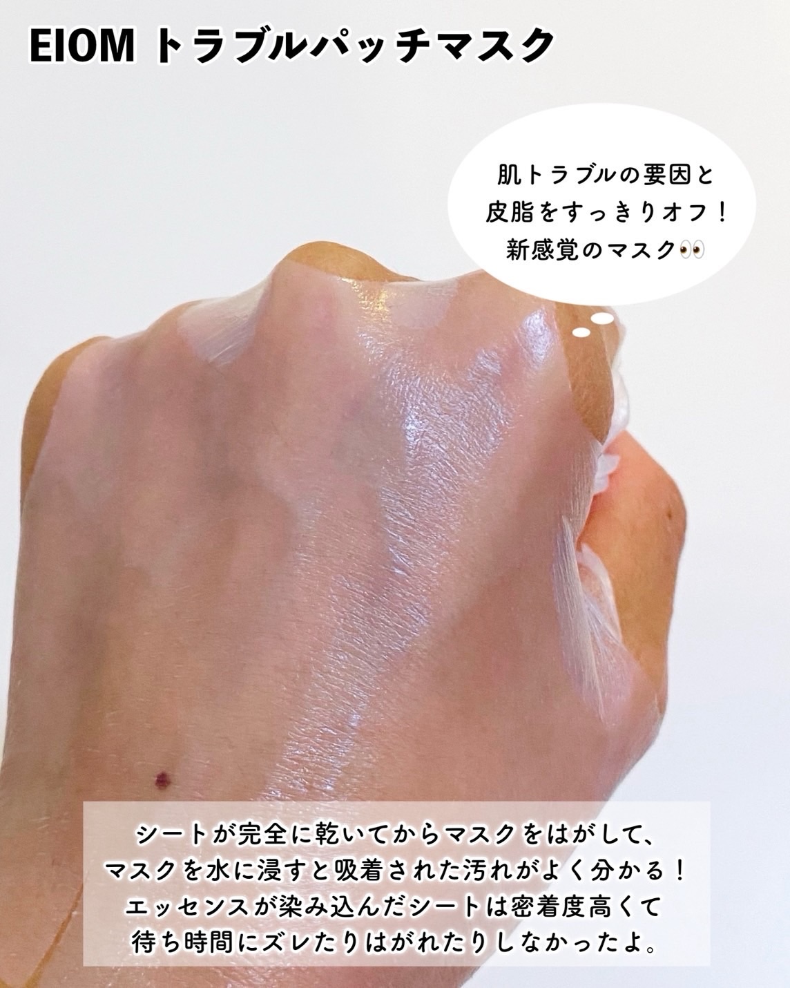 トラブルコントロールパッド/EIOM/トナーパッドを使ったクチコミ（3枚目）