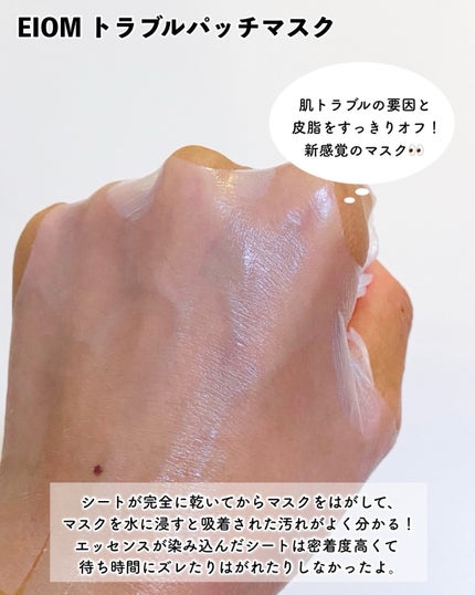 トラブルコントロールパッド/EIOM/トナーパッドを使ったクチコミ(3枚目)