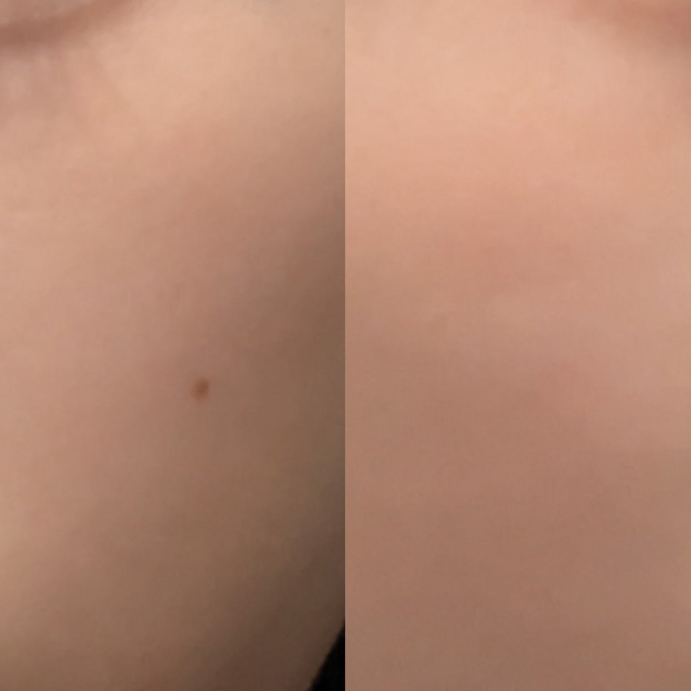 アークパントンヒール /Balance Flow/美容サプリメントを使ったクチコミ(3枚目)