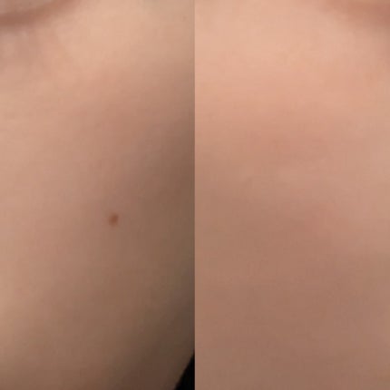 Balance Flow アークパントンヒール のクチコミ「1日2粒を目安に続けています💊✨
トラブルケアだけでなく、鎮静や再生を意識した主要成分も含まれ.....」(3枚目)