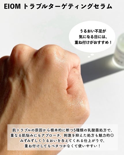 トラブルパッチマスク/EIOM/その他スキンケアを使ったクチコミ(8枚目)