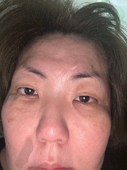 レチアールエヌ スリムパッチ/ACROPASS/シートマスク・パックを使ったクチコミ(6枚目)