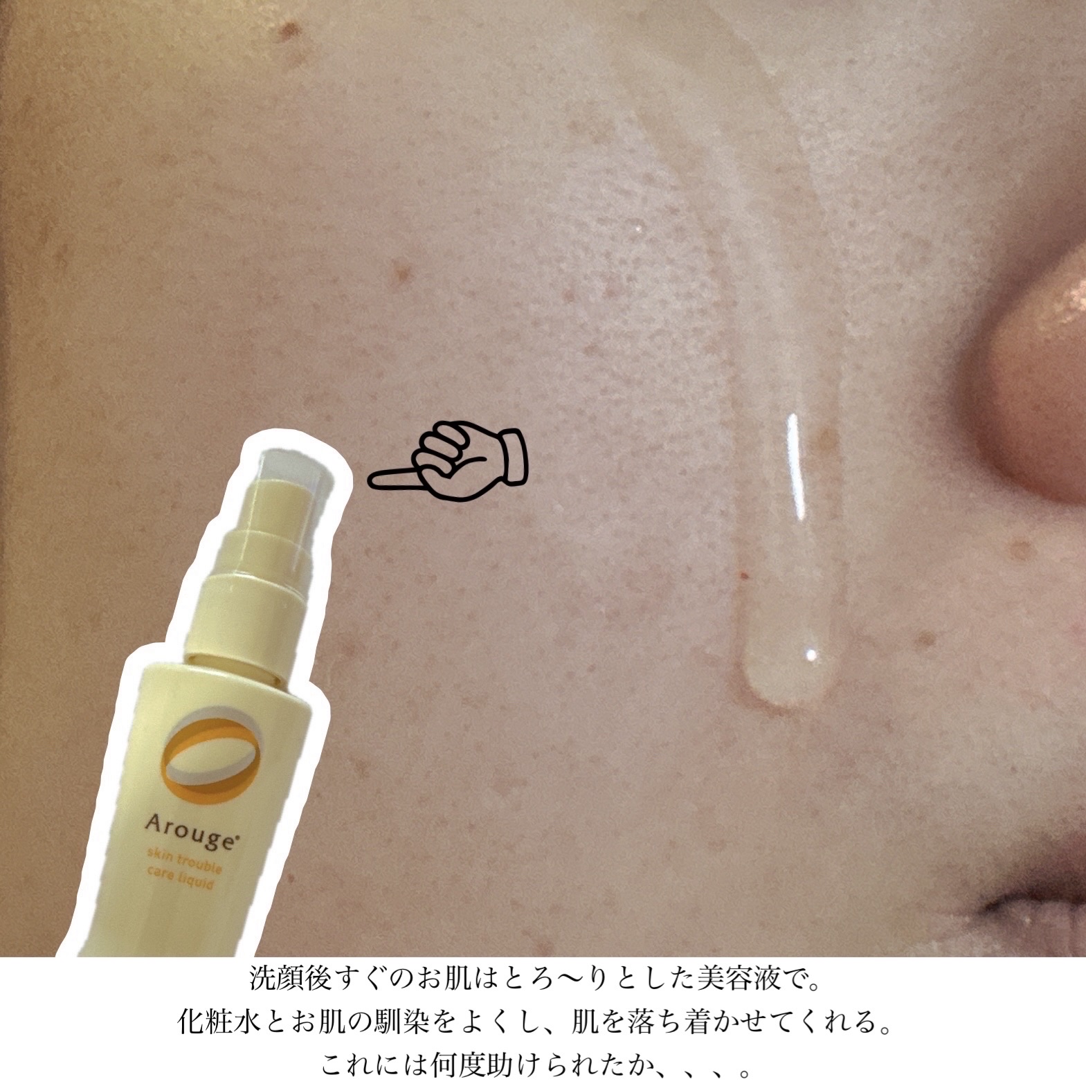 モイスチャー リッチローション(とてもしっとり)/アルージェ/化粧水を使ったクチコミ（2枚目）