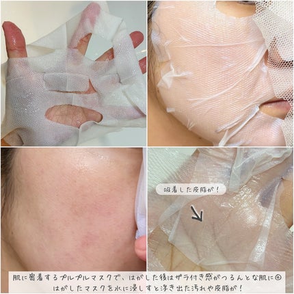 トラブルパッチマスク/EIOM/その他スキンケアを使ったクチコミ(3枚目)