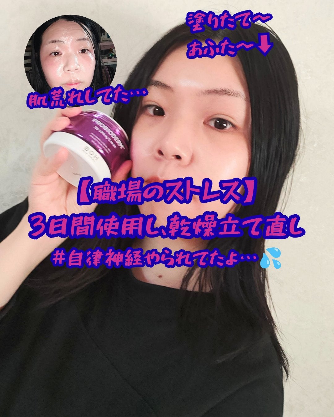 バイオヒールボ プロバイオダーム 3Dリフティングクリーム/BIOHEAL BOH/フェイスクリームを使ったクチコミ(1枚目)