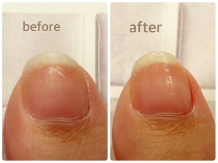ベビーフット 足爪プロティンパック/ベビーフット/レッグ・フットケアを使ったクチコミ(3枚目)