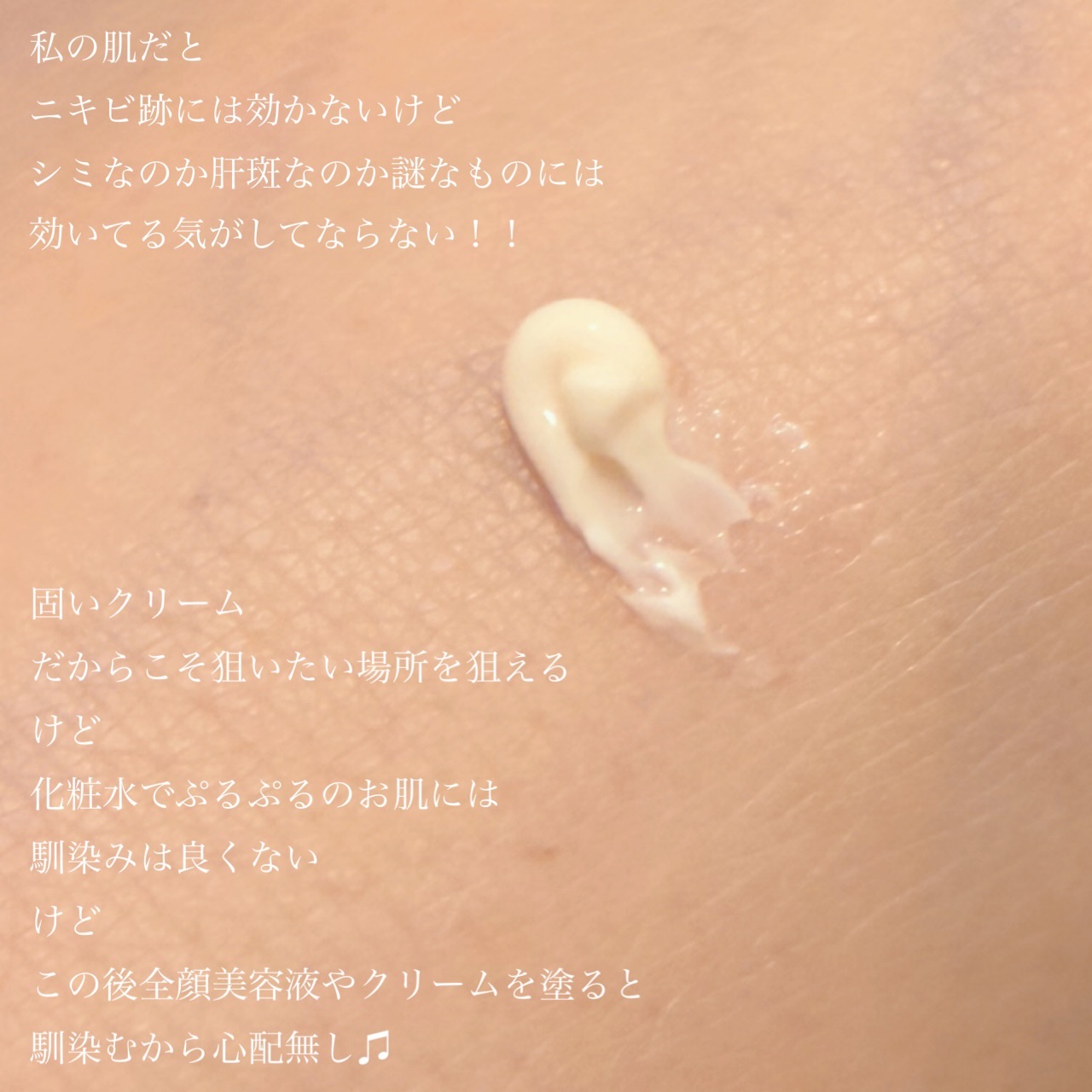 ホワイトショット  SXS/ホワイトショット/美容液を使ったクチコミ（3枚目）