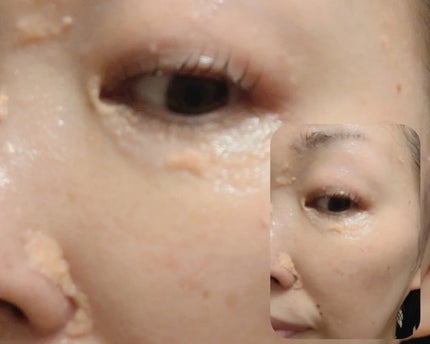 マスクフォンデュ/Quanis/シートマスク・パックを使ったクチコミ(5枚目)