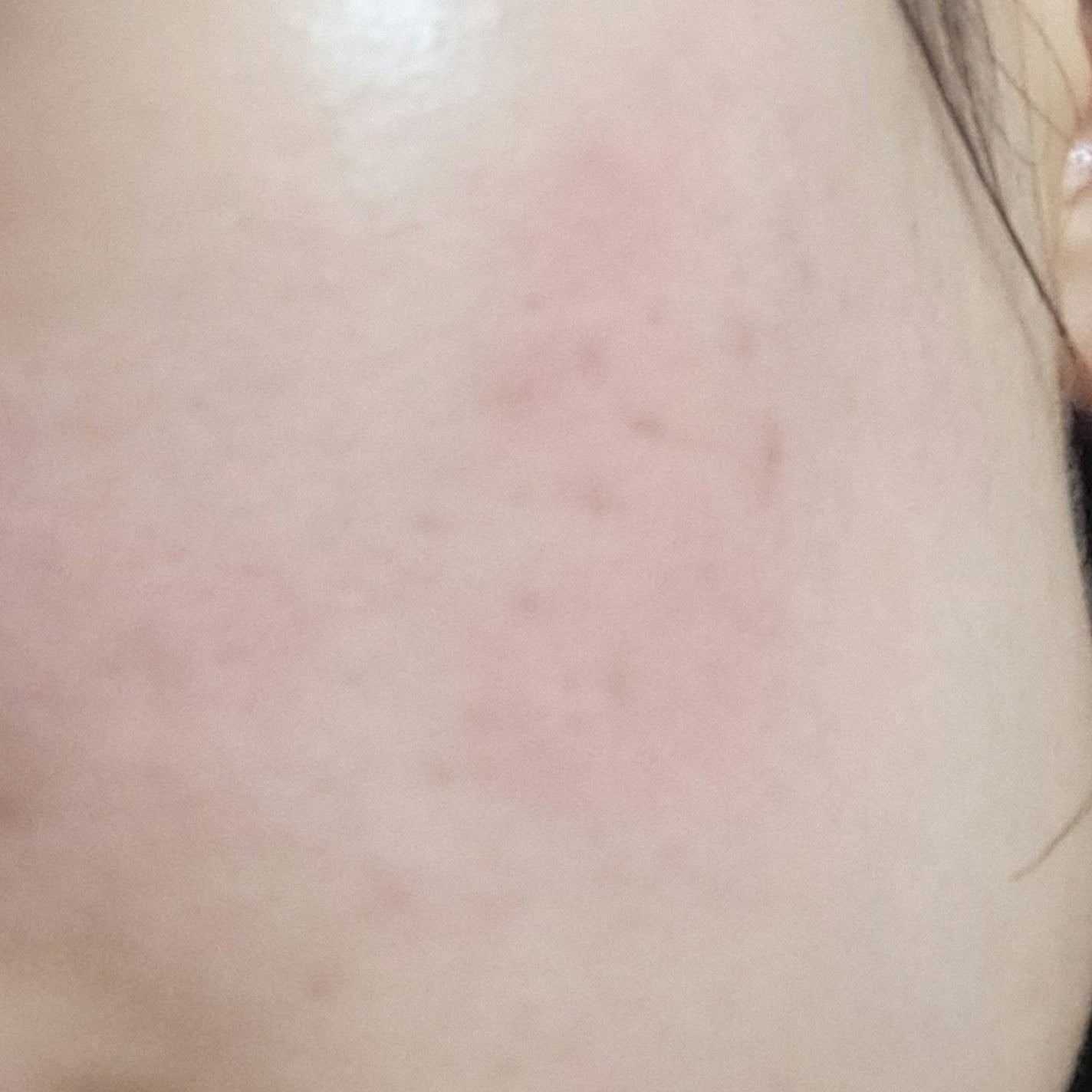 ハトムギ化粧水(ナチュリエ スキンコンディショナー R )/ナチュリエ/化粧水を使ったクチコミ(2枚目)