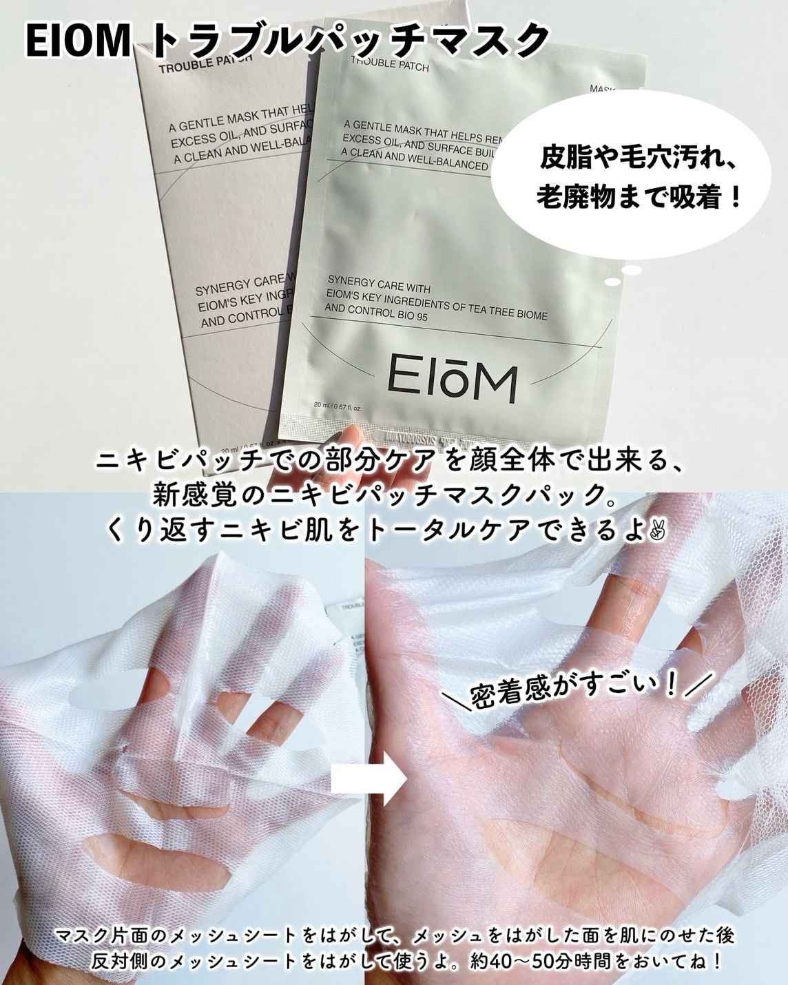 トラブルコントロールパッド/EIOM/トナーパッドを使ったクチコミ（2枚目）