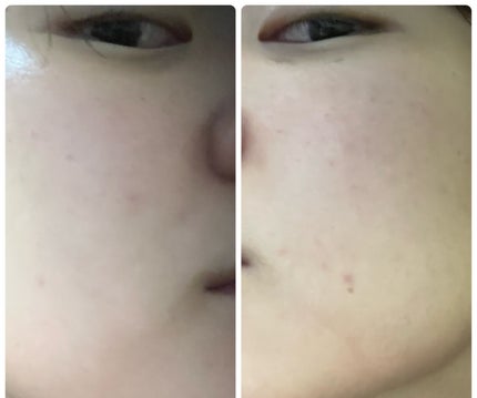 ぽむ on LIPS 「1枚目 2025.12.17エピデュオ 826日目2枚目 20..」(4枚目)