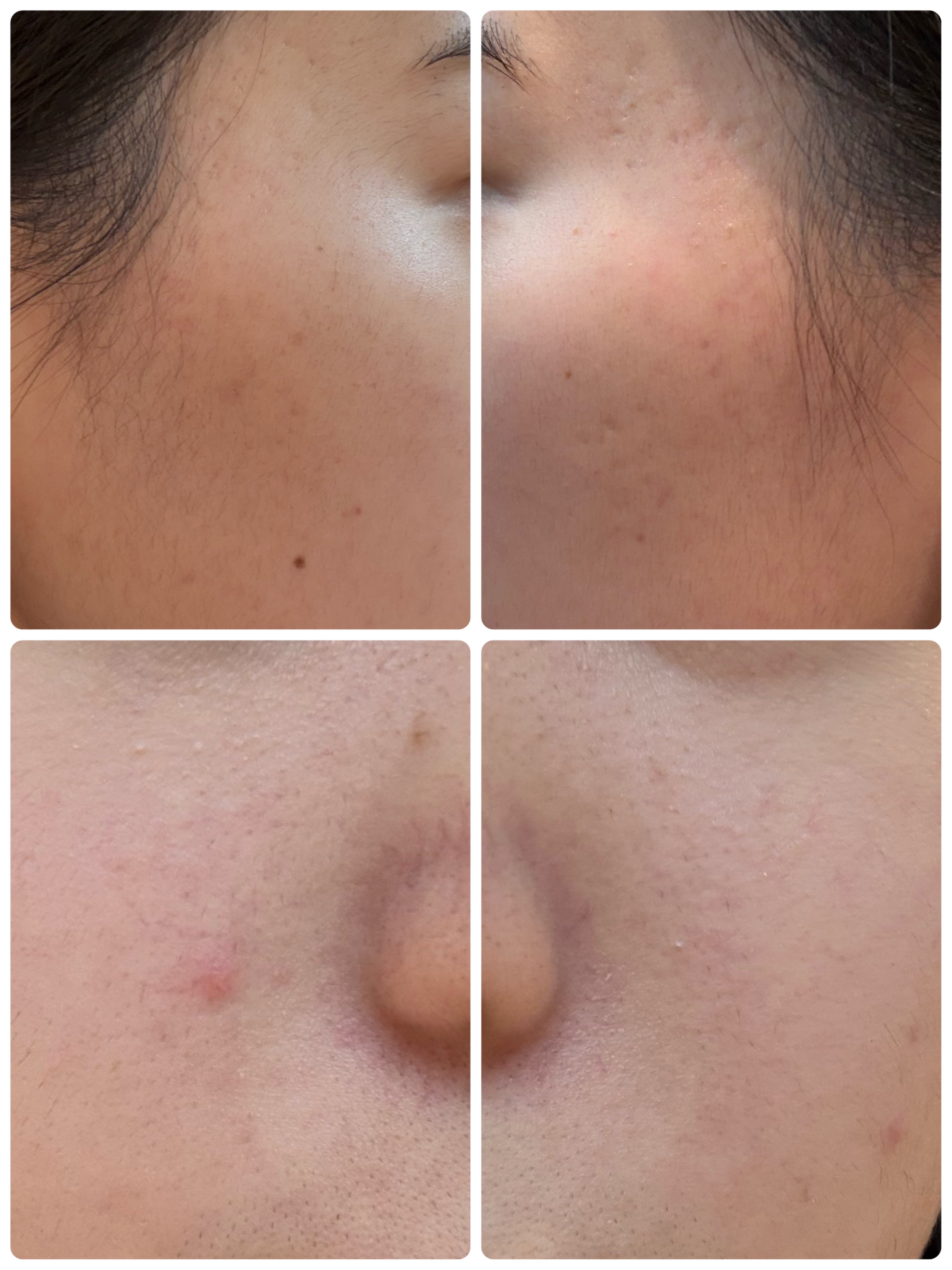 PDRN テンショントナーパッド/VT/トナーパッドを使ったクチコミ（2枚目）