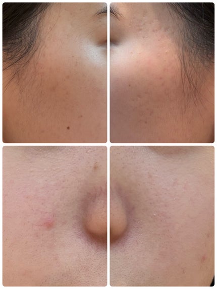 PDRN テンショントナーパッド/VT/トナーパッドを使ったクチコミ(2枚目)