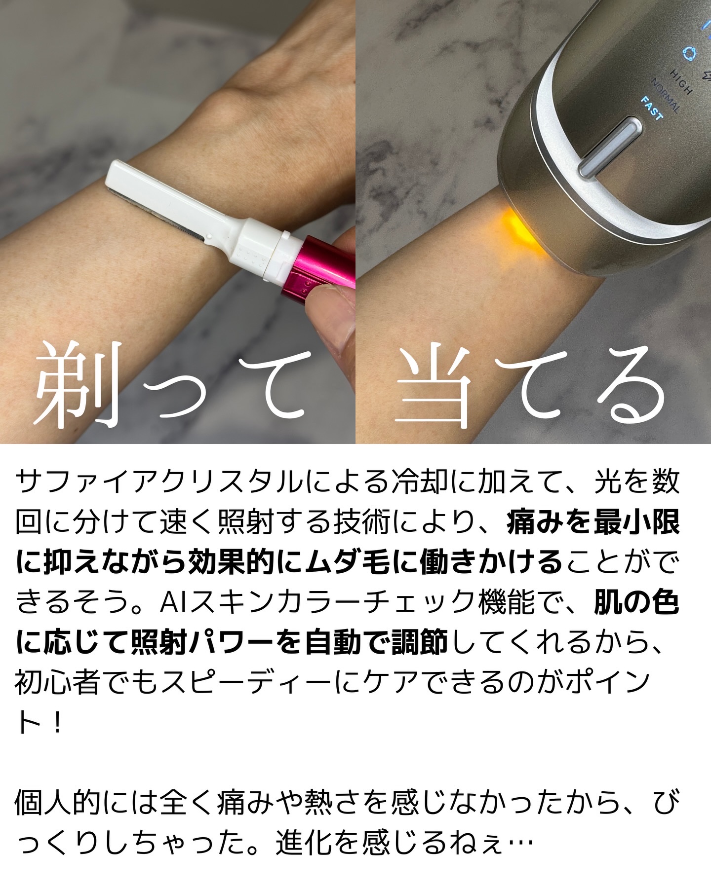 LINKAフレアタッチ プロ/LINKA/家庭用脱毛器を使ったクチコミ（2枚目）