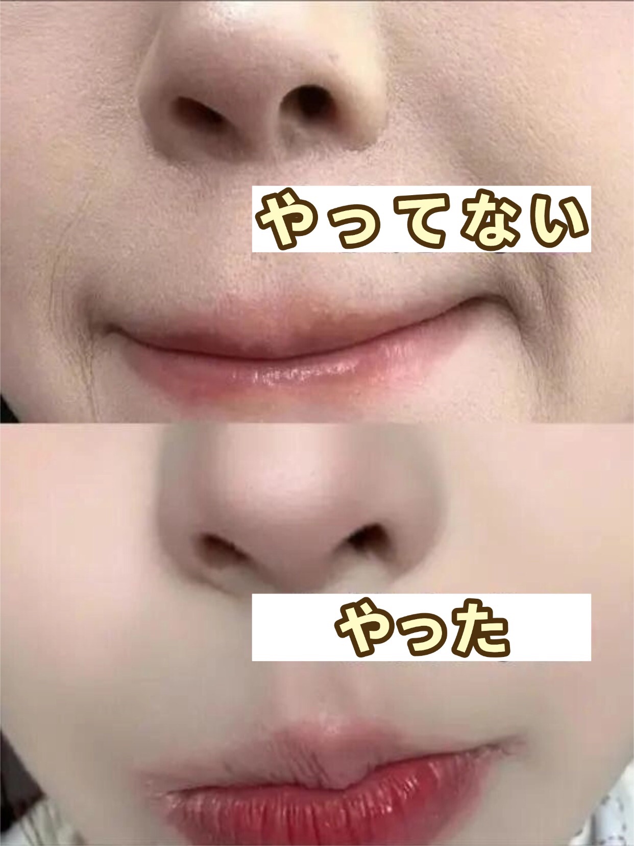 アネトス バランシング トリートメントクリーム/Anetos/フェイスクリームを使ったクチコミ（1枚目）