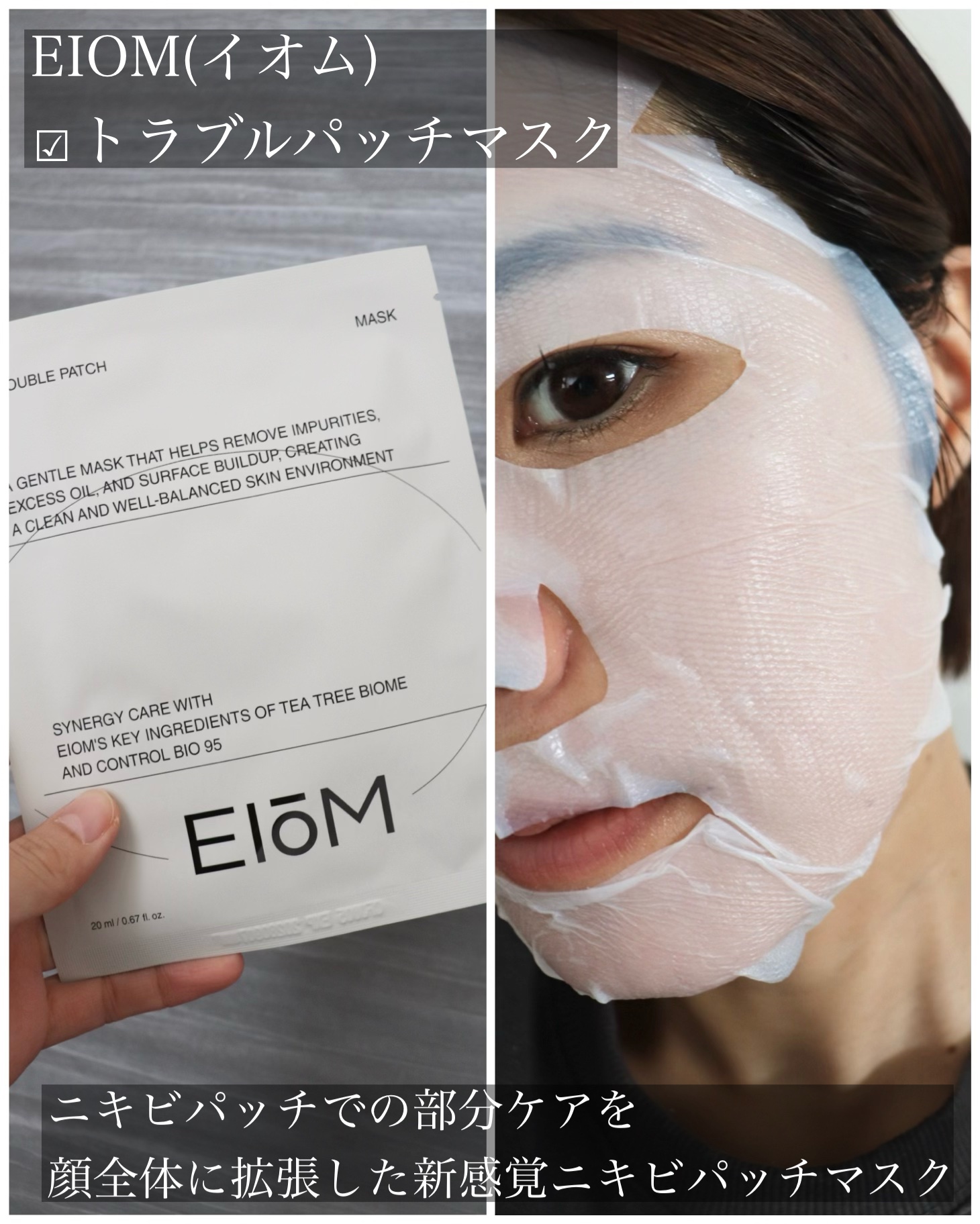 アクネクスアンプル/EIOM/美容液を使ったクチコミ（2枚目）