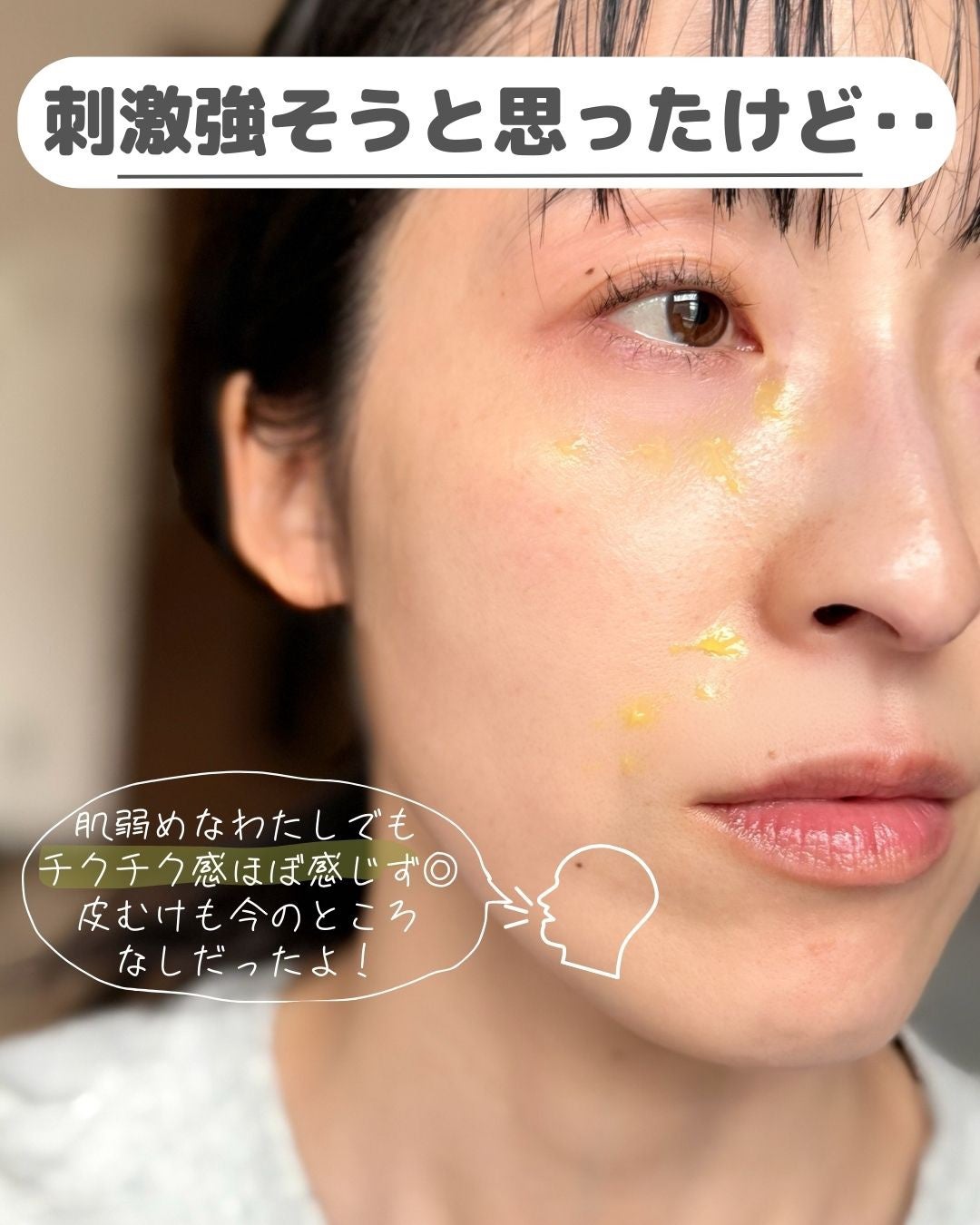 THE ビタA レチノールショット タイトニングブースター/celimax/美容液を使ったクチコミ(5枚目)