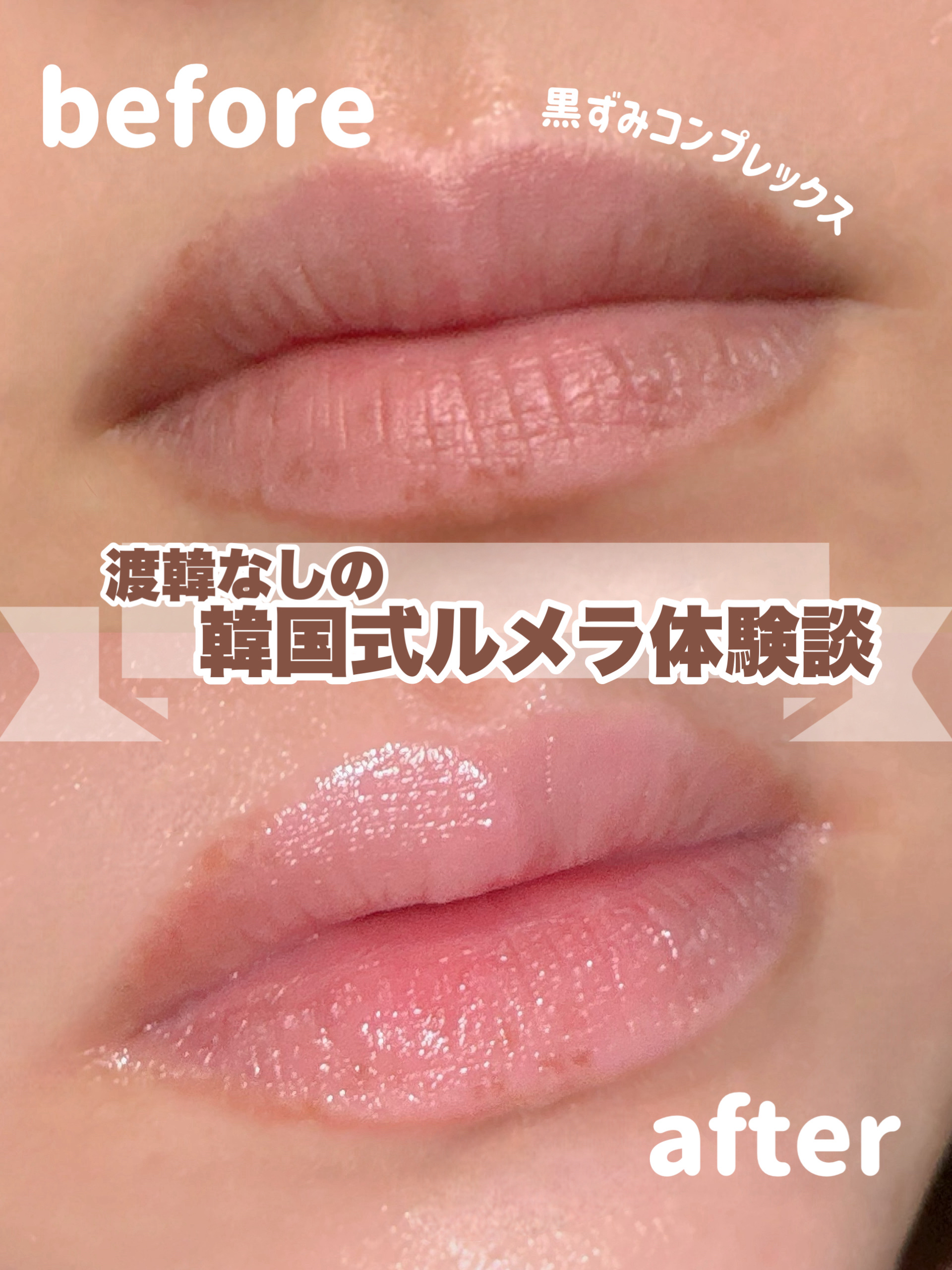 唇の黒ずみがかなりコンプレックスだったのですが、このサロンに行ってからコンプレックスから解放されました✨️

🎀Salon🎀
Puresol 堀江店
【住所：大阪府大阪市西区南堀江1-16-11
RE-008 7FF号】

難波駅から徒