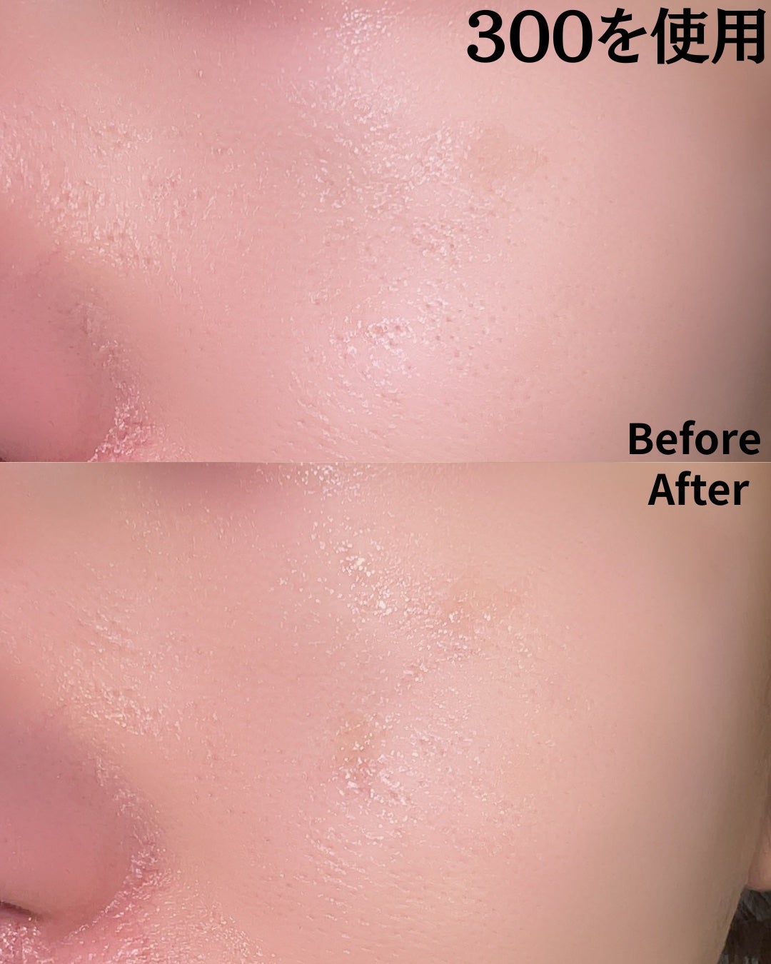 リードルショット100/VT/美容液を使ったクチコミ(4枚目)