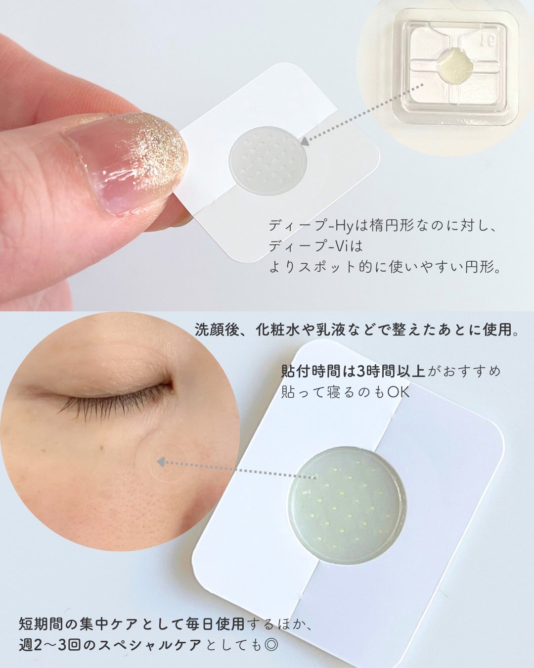 クリニラボ マイクロニードルパッチ ディープ-Hy/大正製薬/シートマスク・パックを使ったクチコミ(6枚目)