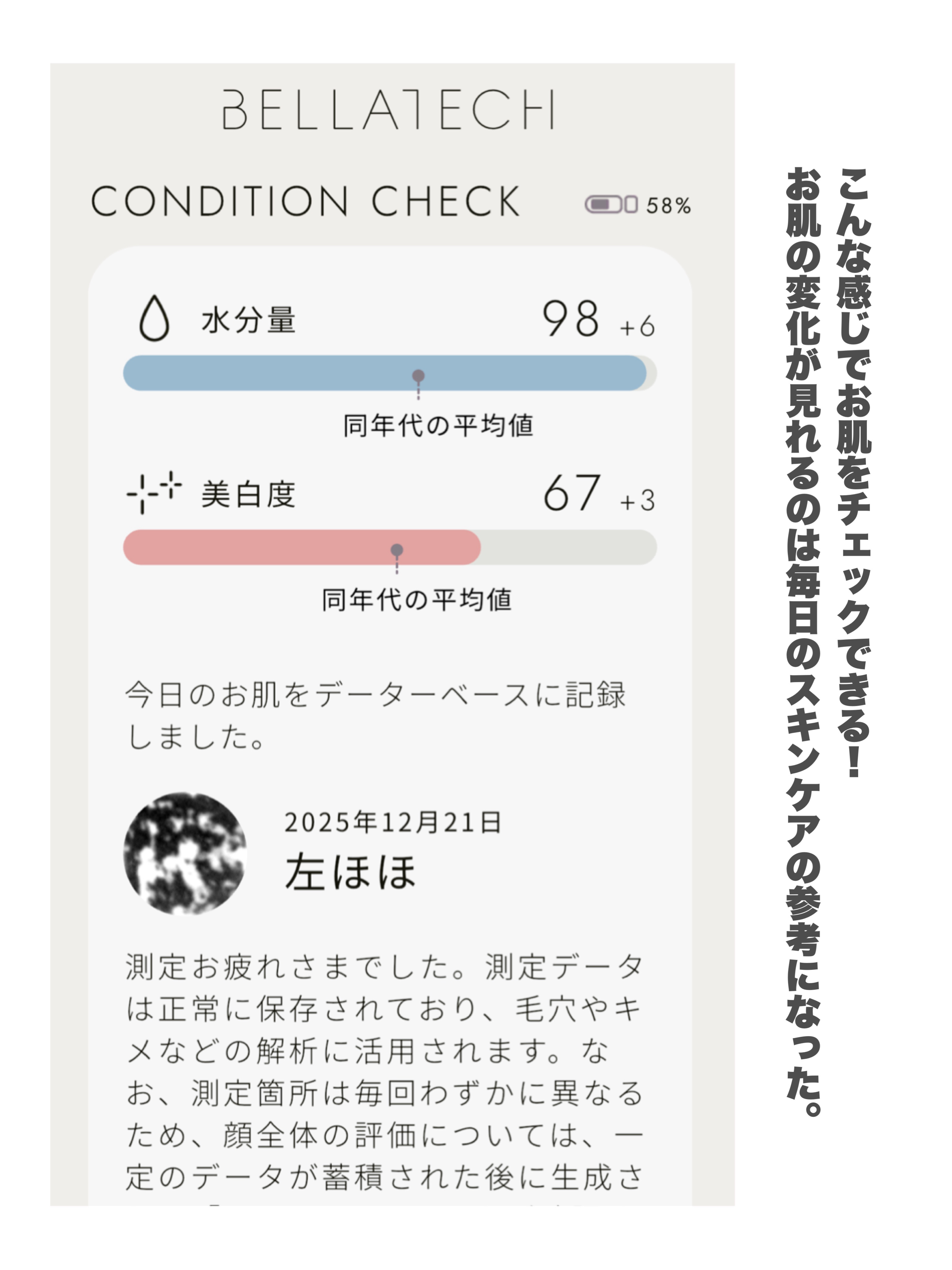 スキンスキャナー/BELLATECH/その他スキンケアグッズを使ったクチコミ（3枚目）