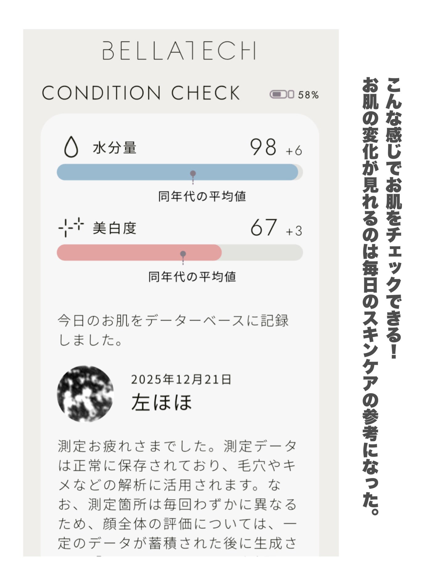スキンスキャナー/BELLATECH/その他スキンケアグッズを使ったクチコミ(3枚目)