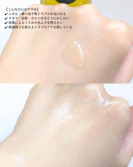 ありちゃん@フォロバ100🤍 on LIPS 「\ゆらぎ肌を、フラットな状態へ🫧✨/@ooznary.japa..」(3枚目)