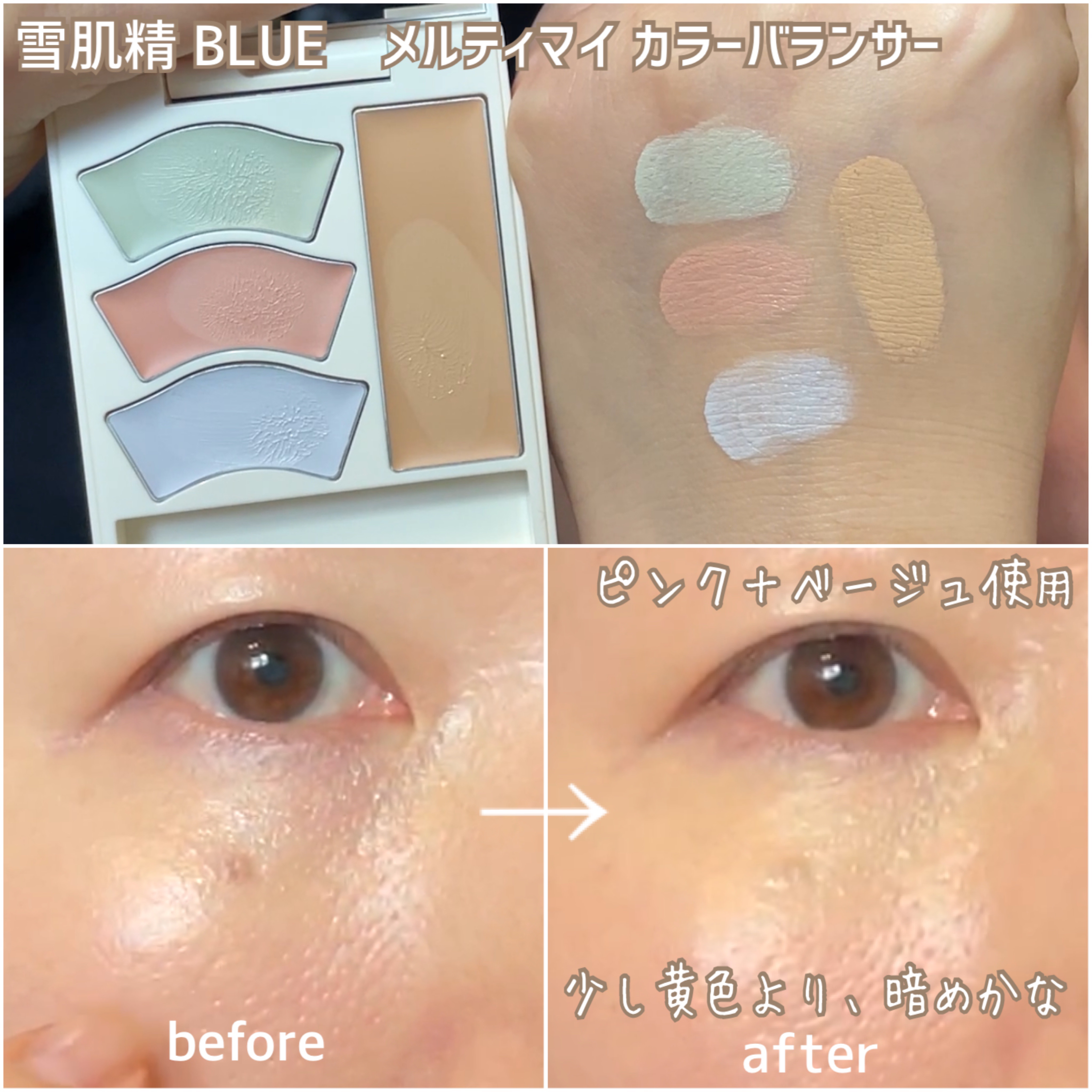 雪肌精 BLUE　メルティ マイ カラー バランサー/雪肌精/パレットコンシーラーを使ったクチコミ（2枚目）