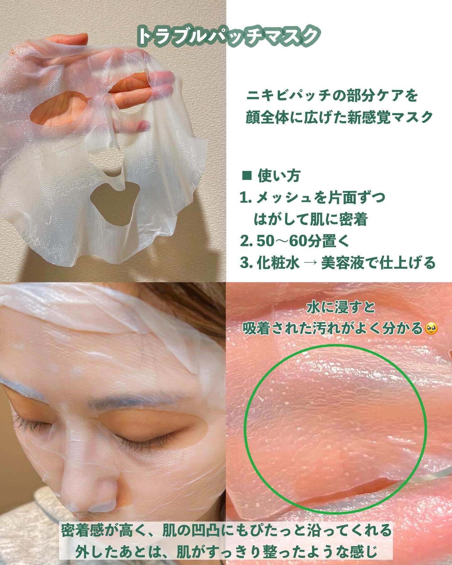 トラブルパッチマスク/EIOM/その他スキンケアを使ったクチコミ（3枚目）