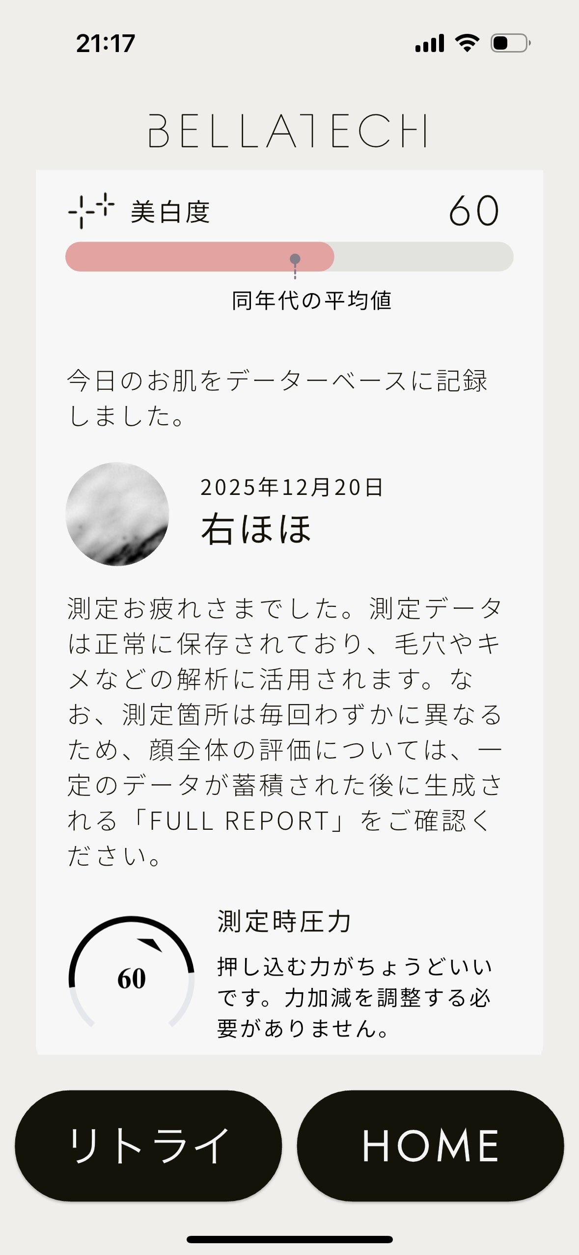 スキンスキャナー/BELLATECH/その他スキンケアグッズを使ったクチコミ(4枚目)