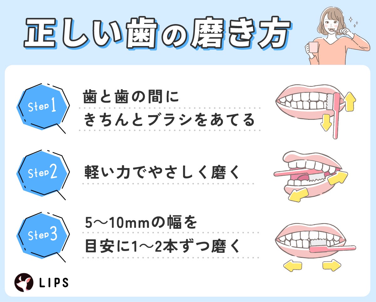 正しい歯の磨き方。歯と歯の間にきちんとブラシをあてて軽い力でやさしく磨く。5~10mmの幅を目安に1~2本ずつ磨く。