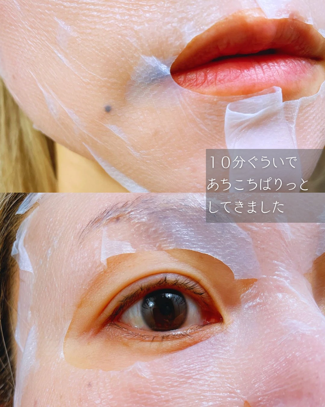 トラブルパッチマスク/EIOM/その他スキンケアを使ったクチコミ(5枚目)