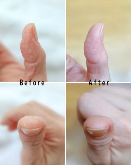 リモイストクリーム<リッチタイプ>/明色/フェイスクリームを使ったクチコミ(4枚目)