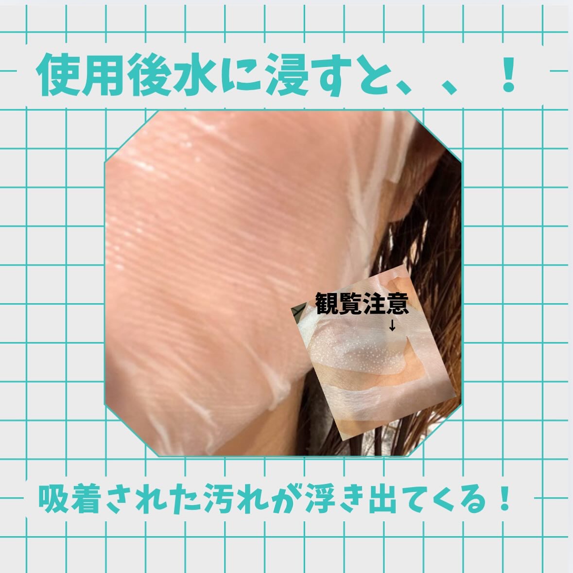 トラブルパッチマスク/EIOM/その他スキンケアを使ったクチコミ（3枚目）