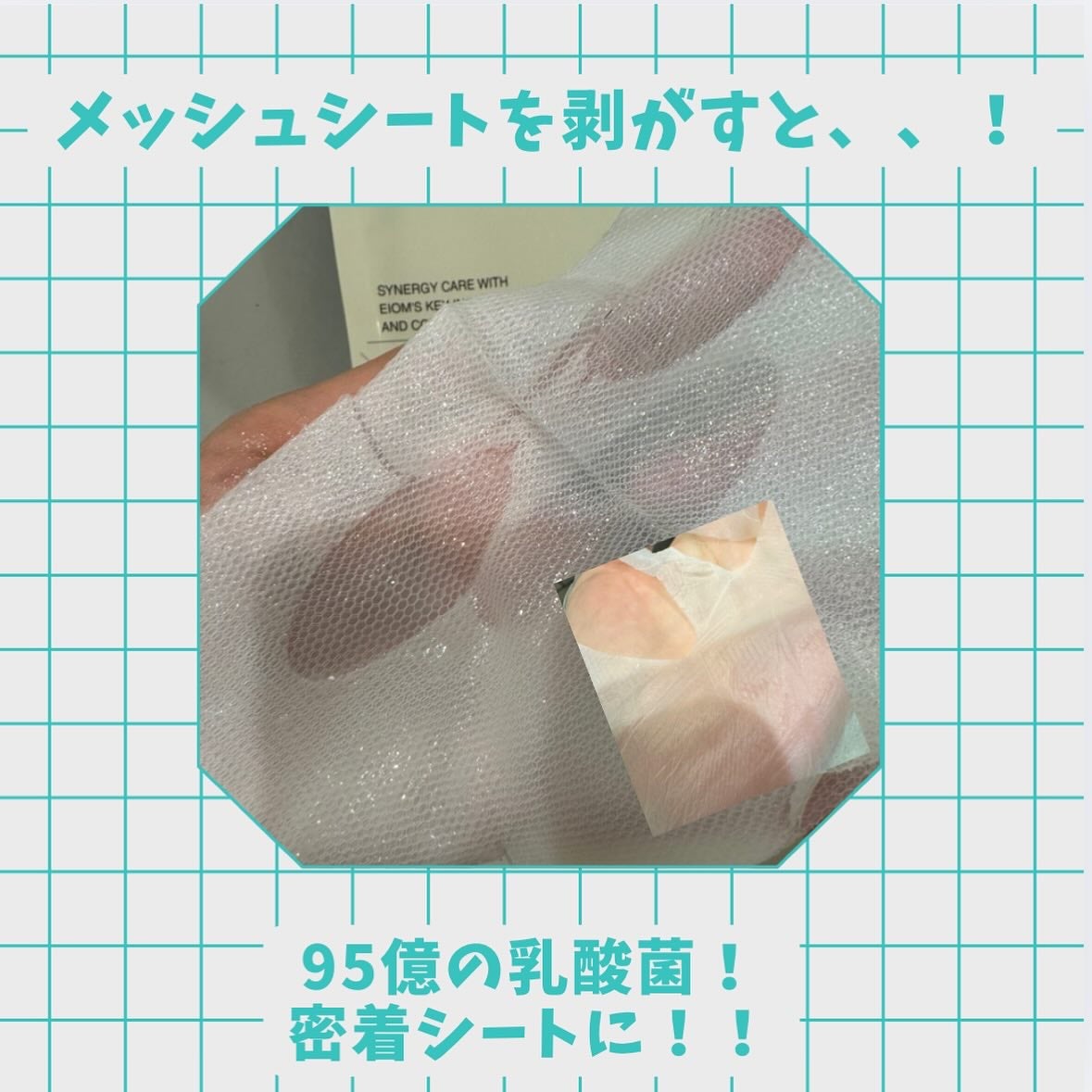 トラブルパッチマスク/EIOM/その他スキンケアを使ったクチコミ(2枚目)