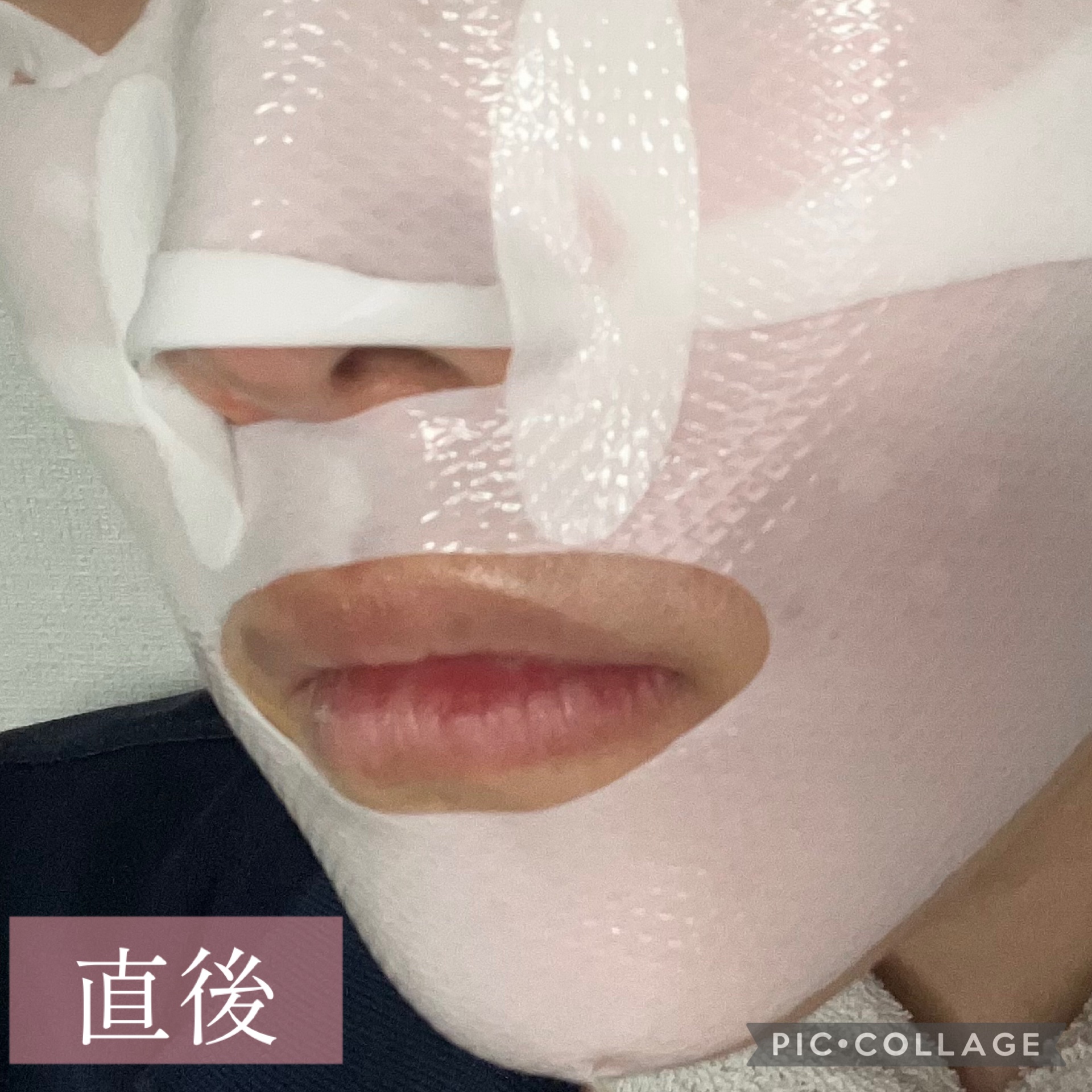 パーフェクト リアル パフォーマンス コラーゲンマスクパック /ダーマフィックス/シートマスク・パックを使ったクチコミ（3枚目）