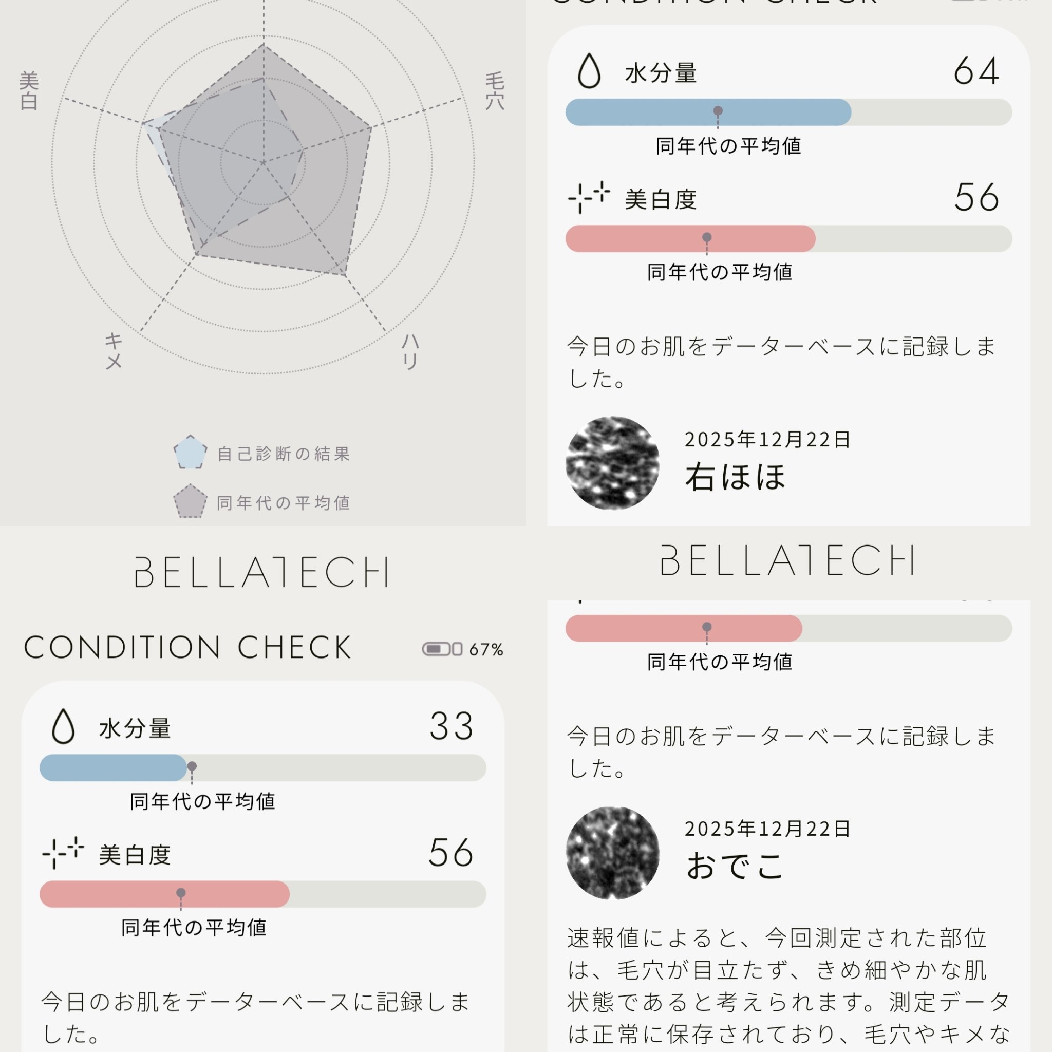 スキンスキャナー/BELLATECH/その他スキンケアグッズを使ったクチコミ（3枚目）