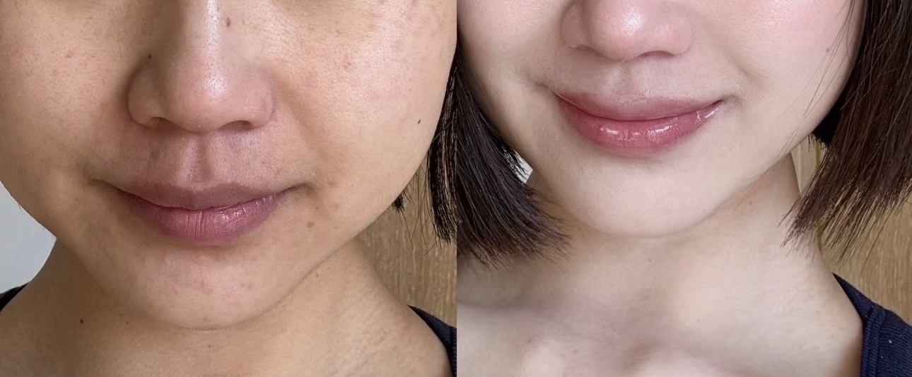 アークパントンヒール /Balance Flow/美容サプリメントを使ったクチコミ（3枚目）