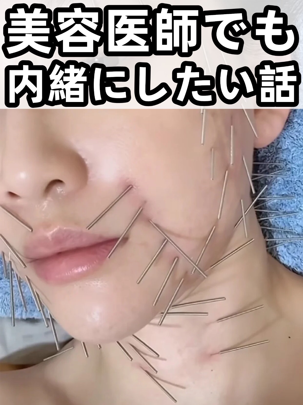 アネトス バランシング トリートメントクリーム/Anetos/フェイスクリームを使ったクチコミ（1枚目）