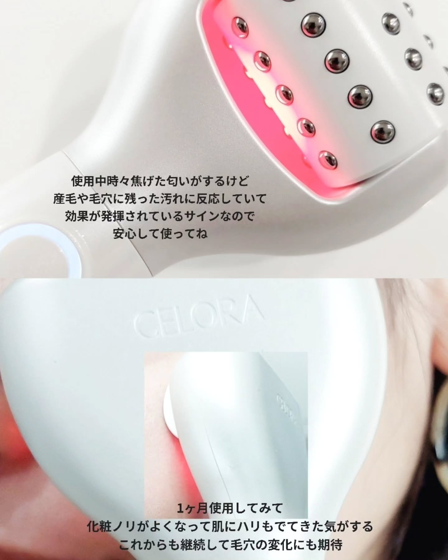 ペンタショット/CELORABY/美顔器・マッサージを使ったクチコミ（3枚目）